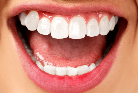 Close up image of large mouth in smile showing all front teeth