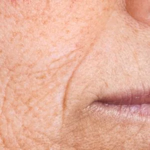 A close up photo of a woman's face with wrinkles